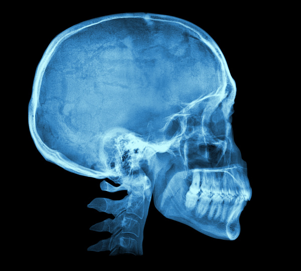 human skull x ray image