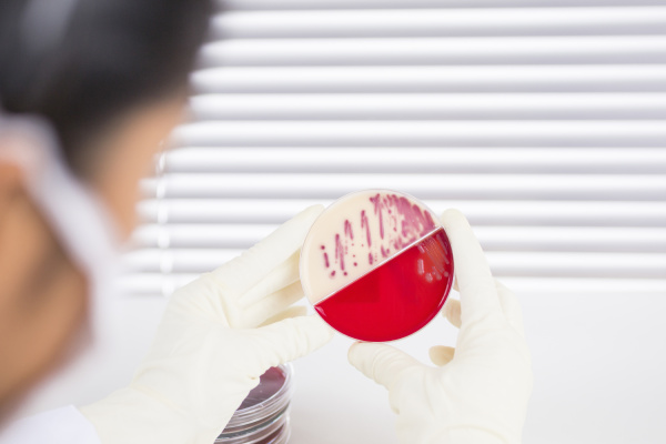 laboratory technician examining agar plate with