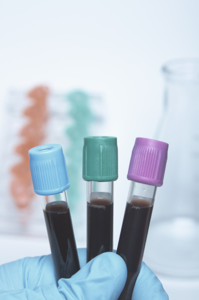 color coded blood tubes containing synthetic