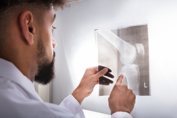 doctor examining knee x ray