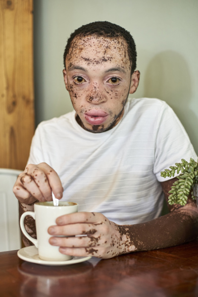 young man with vitiligo having a