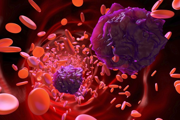 3d rendered illustration of leukemia cells