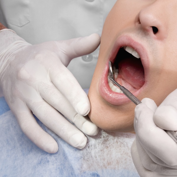 dentist examining a man s teeth