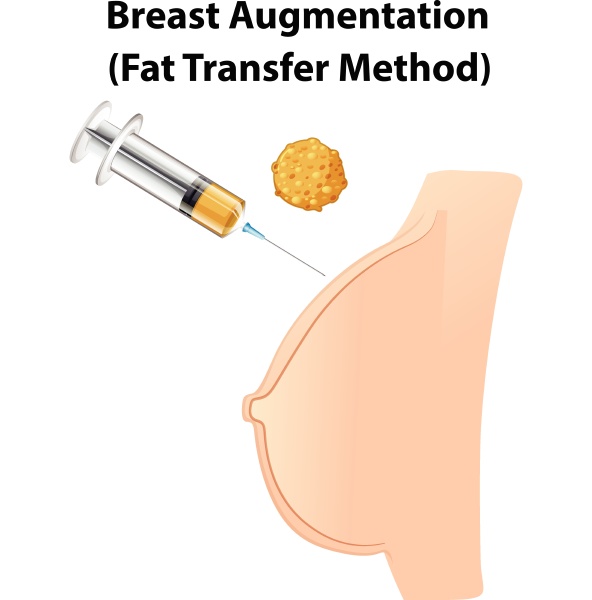 a human anatomy breast augmentation