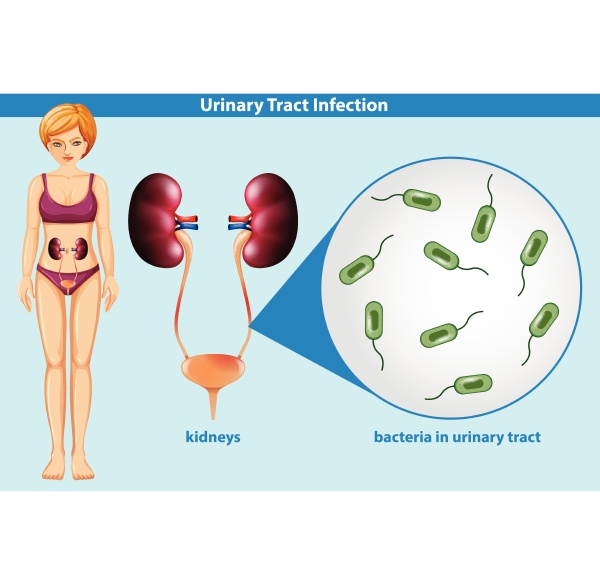 human anatomy of urinary tract infection