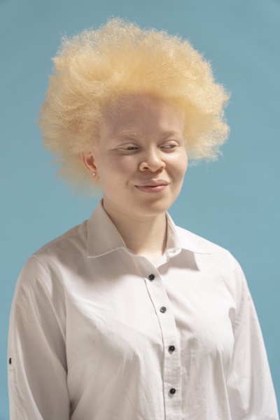 studio portrait of albino woman in