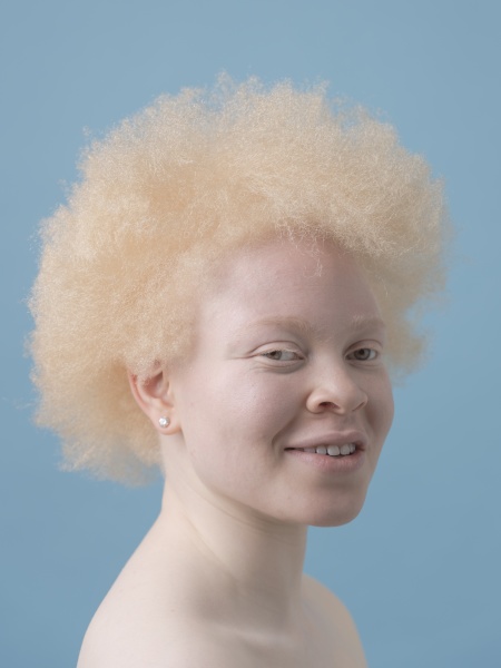 studio portrait of smiling albino woman