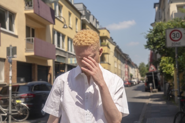 germany cologne albino man