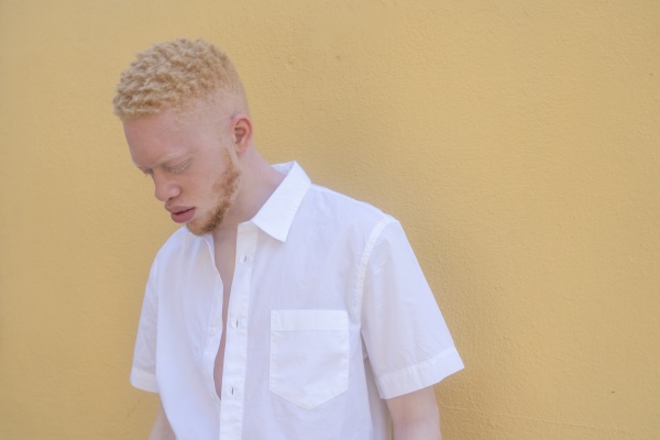 germany cologne albino man