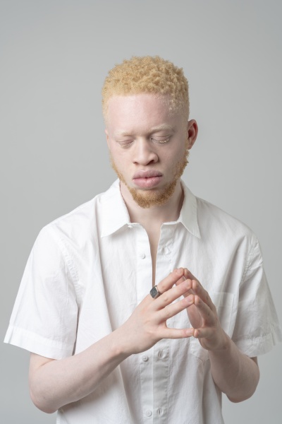 studio portrait of albino man in